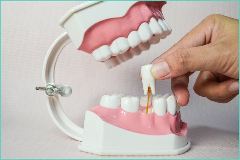 artificial gums and teeth for extraction example purposes