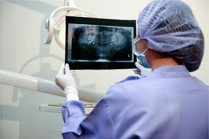 Doctor looking at dental X-Rays