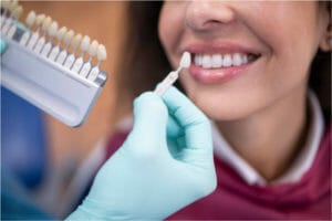 Close-up image of a woman receiving dental crowns during a dental procedure.