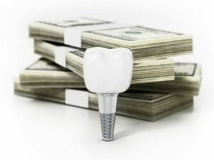 dental implant in front of cash