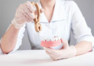 woman holding artifical gums and teeth to mimick wisdom teeth removal