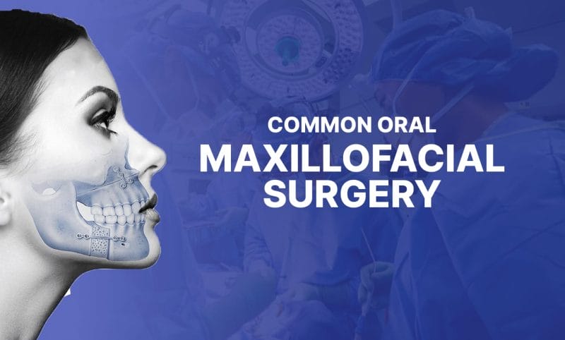 image text: Common Oral Maxillofacial Surgery