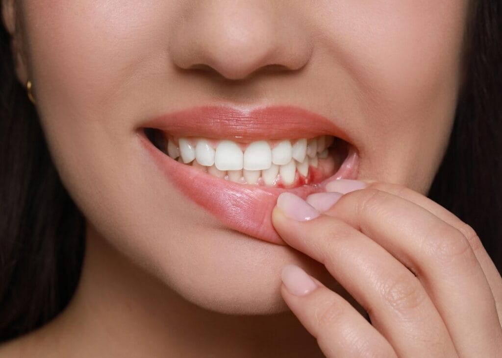 Close-up of a person gently pulling down their lower lip to reveal healthy teeth and gums.